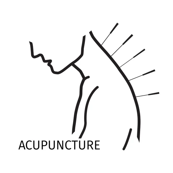 Acupuncture 