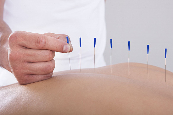 Acupuncture for pain relief in Birmingham